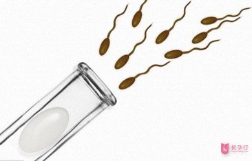 應該怎樣提高試管嬰兒胚胎質量呢?