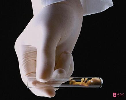 去美國做試管嬰兒價格怎么樣?