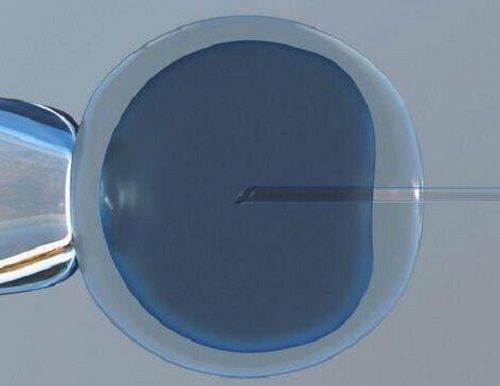 俄羅斯試管嬰兒醫院有哪些