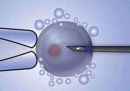 美國試管嬰兒的費用要多少？